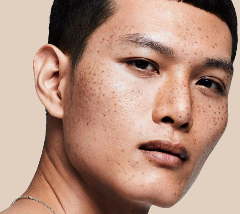 Oily Skin